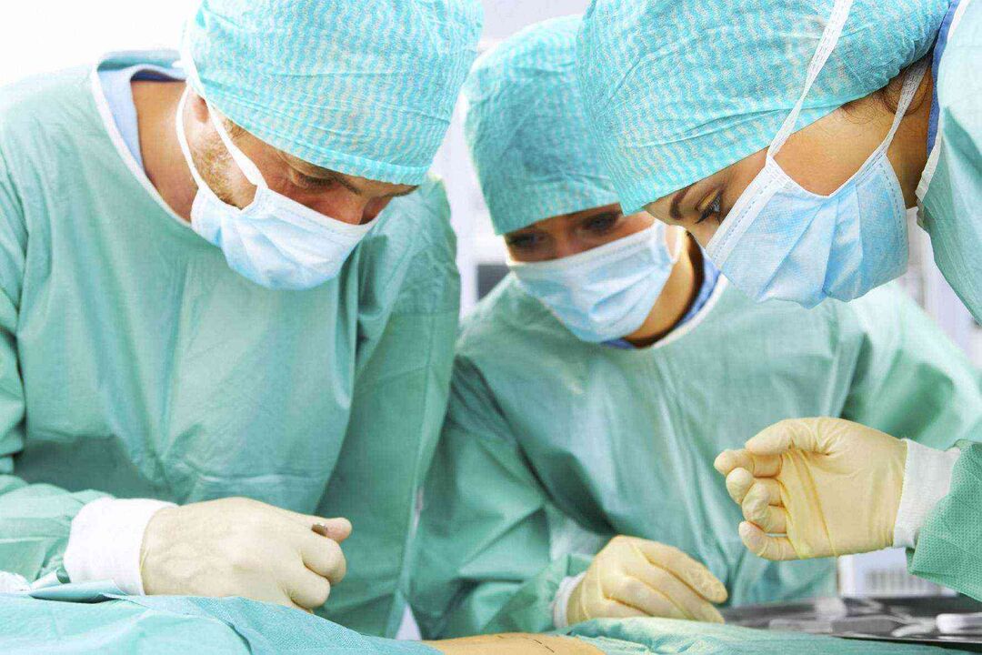 Penis enlargement surgery and price photo 3