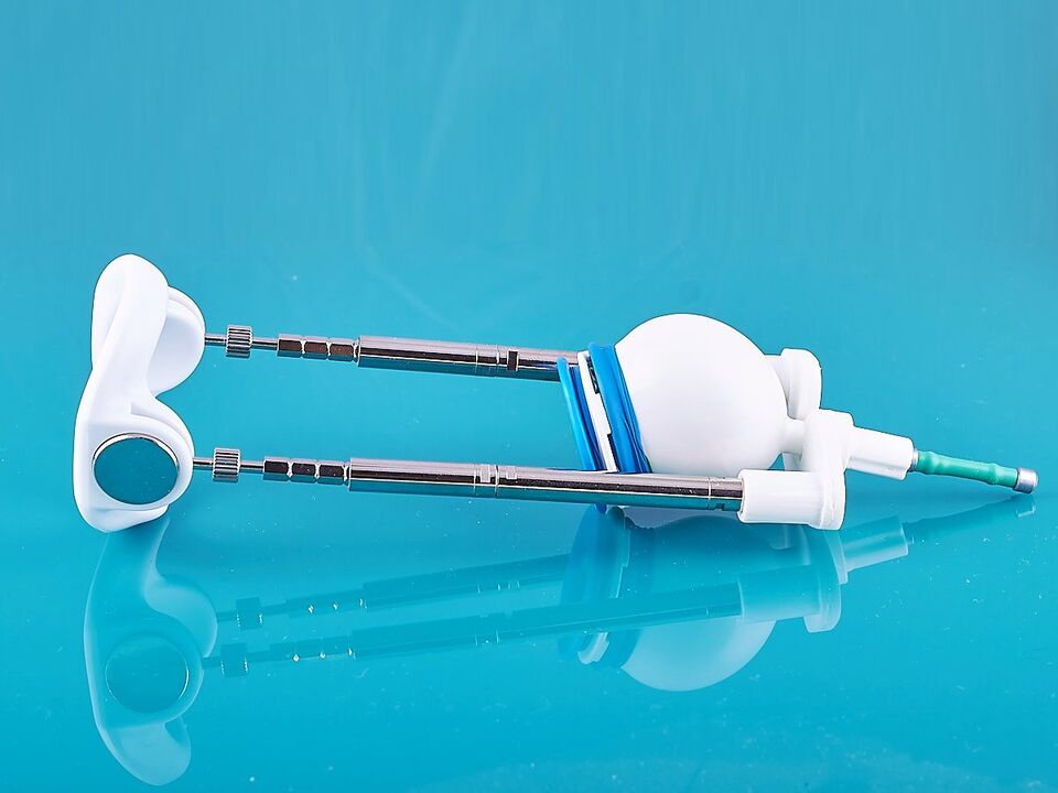 The extender helps to improve the result of the ligamentotomy